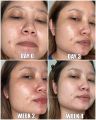 PRODUK TERBARU - LACOCO GRAPE FRUIT ACNE FIGHTER SERUM NASA - LACOCO NASA/Lacoco Grape Fruit Acne Fighter Serum/ Serum Acne / mengatasi beruntusan /mengurangi timbulnya jerawat / merawat tekstur dan elasitas wajah. 