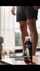 Varicose Vein Healing herbal oil