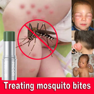 Mosquito Repellent Cream baby ubat nyamuk stick penghalau nyamuk comfrey ointment fast reduce swelling relieve itching ubat nyamuk baby anti mosquito防蚊驱蚊止痒消肿紫草膏