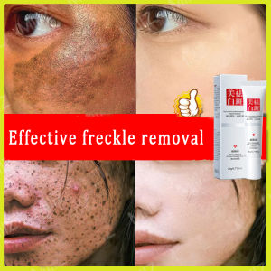 🔥Cadia👍100% original Effective freckle removal whitening cream melasma removal cream serum anti melasma and dark spots cream anti aging cream and wrinkles skin brightening moisturizer skin care cream melasma and pekas remover original