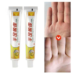Skin Peeling Cream Oil Foot Cream / Krim Tumit Kaki Pecah - Pecah Mengupas Sel Kulit Mati