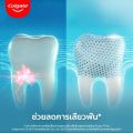 (แพ็คคู่) Colgate Sensitive Pro Relief คอลเกต ยาสีฟัน เซนซิทีฟ โปรรีลีฟ ขนาด 110g 2 หลอด ลดการเสียวฟัน ได้รวดเร็ว ยาวนาน. 