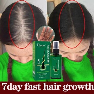 Hair Growth Tonic Spray 120ml Anti Hair Loss Serum Fast Hair Growth Treatment Essence Preventing baldness for Men Women