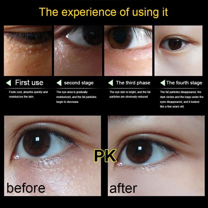 %E3%80%90COD%E3%80%91Eye%20cream%20remove%20repair%20fat%20particles%20eye%20wrinkles%20bags%20under%20the%20eyes%20dilute%20dark%20circles%2020g%20-%20Image%206