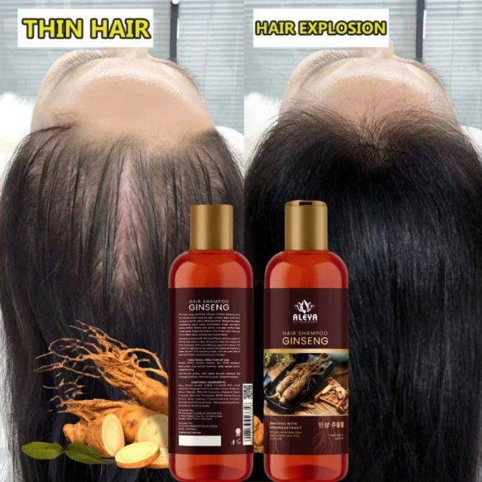 Sampo%20Penumbuh%20Rambut%20Cepat%20Panjang%20Gingseng%20Obat%20Rambut%20Rontok%20Parah%20Botak%20Ketombe%20-%20Image%206