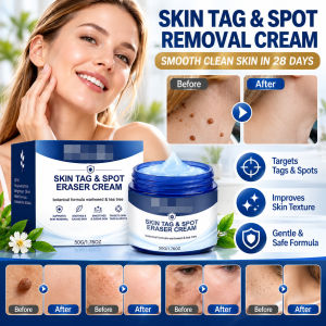 Skin Growth Remover Cream Wart Removal Skin Tag Care Dark Spot Care Cream Targeted Skin Application Body Care