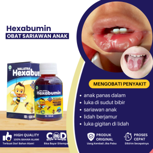 Obat Sariawan Anak Obat Panas Dalam Obat Luka Di Sudut Bibir Obat Bibir Pecah Pecah Anak Bibir Anak Kering Obat Luka Gigitan Di Lidah Obat Lidah Kandidiasis Lidah Jamuran Anak - Walatra Hexabumin