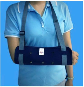 Treo Tay Sida Nâng Đỡ Tay Bệnh Nhân Giúp Giữ Tay cân Bằng thoải Mái Trong Quá Trình Điều Trị gãy tay bó bột chấn thương
