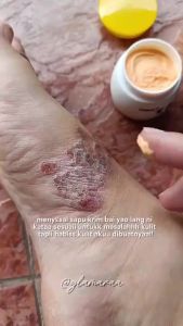 BAIYAOLANG 20g 止痒 Cream ubat gatal kulit skincare wound krim itchy ekzema ointment cream cream gatal ringwo eczema cream YELLLOW CREAM UBAT KUNING UBAT CINA UBAT KURAP NATURAL