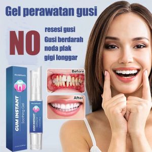 Gum instant Gel Penguat gigi Otek  Penguat gigi tambal gigi Penghilang karang gigi pembersih gigi kuning