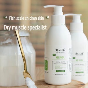 Dry skin moisturizing urea body milk fish scale chicken skin cream VE fruit acid hair follicle chicken skin autumn and winter to moisturize women and men