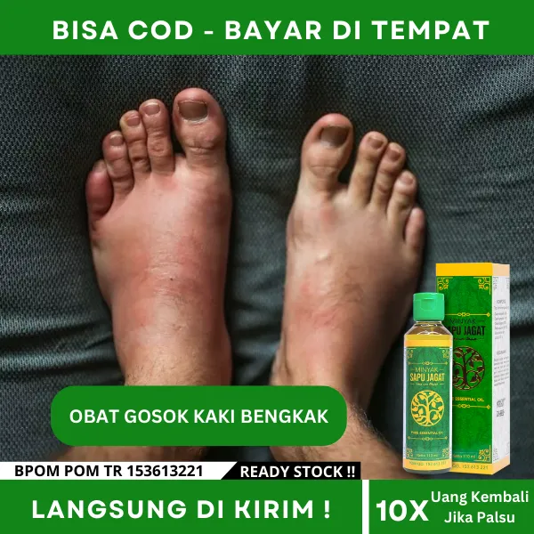 Obat Kaki Bengkak Lansia dan Nyeri, Obat Kaki Bengkak Karena Kesleo