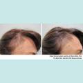 💯Viviscal Pro / Professional 180 pills Hair Loss Supplement for Hair Growth 3 Months Supply *2 Days Delivery*. 