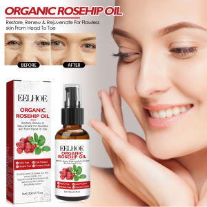 EELHOE Rosehip Facial Oil Lightweight Dry Oil with Hyaluronic Acid Vitamin E 60ml Fast Absorbing Serum for Dehydrated Skin Comedogenic Rosehip Oil Face Serum Fade Fine Lines Moisturizing Remove Wrinkles Improve Skin Elasticity Firming Facial Serum