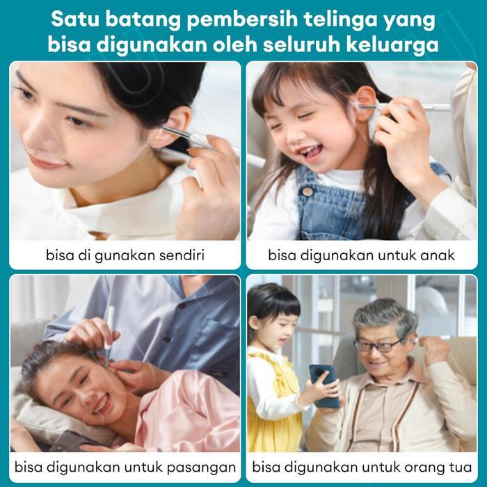 %E3%80%90IN%20STOCK%E3%80%91ALAT%20PEMBERSIH%20TELINGA%20LED%20EAR%20SPOON%20TERHUBUNG%20DENGAN%20EAR%20SPOON%20CERDAS%20UNTUK%20MEMBERSIHKAN%20SALURAN%20TELINGA%20ANAK-ANAK,%20DEWASA,%20DAN%20LANSIA%20SECARA%20NIRKABEL%20DENGAN%20WIFI%20TAHAN%20AIR.%20NON-MEDIS%20BLACK%20-%20Image%202