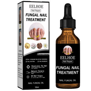 agetet EELHOE Nail Repair Liquid Thickening Bright Nail Removing Onychomycosis Dead Skin Repair Moisturizing Nail Art Nutrient Nursing Liquid