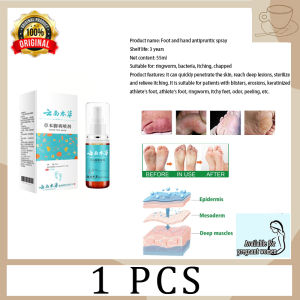 anti fungal spray foot spray foot care foot odor spray 50ml Feet Reducing Bacteria Say Bye to Fungus and Athlete Feet for a Healthy Feet