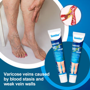 Varicose Veins Cold compress Remover Cream Relieves heaviness swelling for Varicocele Spider Vein