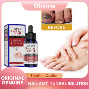 EELHOE Quick Repair Fungal Nail Treatment Liquid Treat Paronychia Fungus Prevent Infection Crack Discoloration Rough Foot Care Products Foot Repair Essence Toe Nail Fungus Removal Gel Anti Infection Cream Fungal Nail Removal