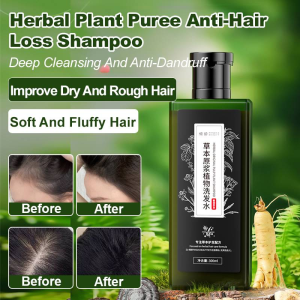 Smooth and fluffy hair Conditioner Shampoo Deep cleansing and antidandruff Improve scalp condition Nourish hair antihair loss shampoo Improve dryness and roughness Degreasing