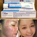 Derma Forte 15g CHÍNH HÃNG Kem Chấm Mụn Giảm Mụn Giảm Vết Thâm - Gel Ngừa Mụn Cao Cấp, gom cồi mụn nhanh chóng. 