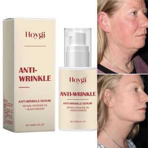 new 2% Retinal Anti Aging Wrinkle Serum Ginseng Facial Essence Firming Pores Brightening Face Moisturizer Korean Skincare hot