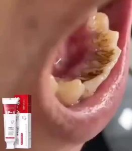 SP-4 Probiotics Toothpaste Whitening Antibacterial Brighten Teeth Fresh Breath Remove Bad Breath Remove Yellow Tooth Stains