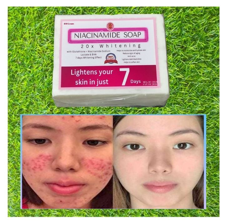 NIACINAMIDE SOAP ORIGINAL TRENDING WITH GLUTATHIONE ANTI AGING LIGHTENS
