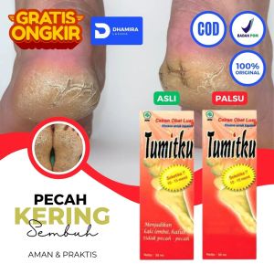 Tumitku - Salep Krim Obat Masker Kaki Pecah2 Dan Kering Parah Yg Ampuh Pembersih Penghalus Tumit Pecah Mengelupas