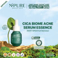 NPURE Anti Acne Serum / Serum Anti Jerawat / Kulit Berminyak / Serum Wajah Bebas Jerawat. 