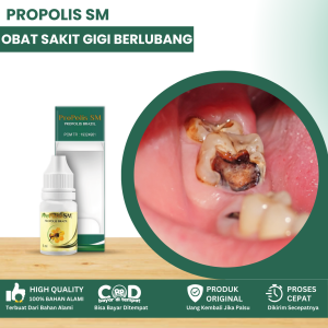 Obat Sakit Gigi Berlubang Obat Penghilang Gusi Bengkak Obat Sakit Gigi Keropos Obat Gigi Goyang Obat Gigi Bolong Penghancur Gigi Berlubang Obat Sakit Gigi Dan Linu Obat Kumur Sakit Gigi Nyeri Gigi Dengan Propolis SM