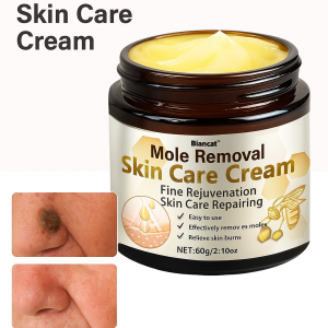 Repair Paste Improve Skin Condition Safety Care Cream Cleaning Mole Removal Smooth and Delicate