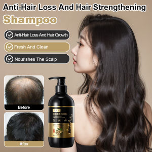 Polygonum multiflorum and ginseng anti-hair loss and strengthening shampoo Hair Loss Prevention Shampoo Ginseng Shampoo  Scalp Nourishment Healthy Hair Growth