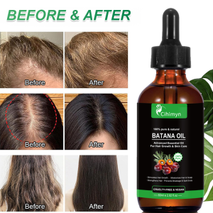 Hair Growth Conditioning Oil Essential Oil Hair Care NonIrritating Effective Hair Growth Promoting