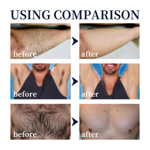 男士脱毛喷雾 胡须腋下腿部胸部毛发温和不刺激去毛净  Mens Hair Removal Spray Beard Armpit Leg Chest Hair Mild Non-Irritating Hair Removal Net