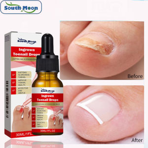 Serum Nấm Móng Phục Hồi Móng Thối Móng Hư Nấm Móng Giúp Đẹp Móng Từ Thảo Dược