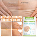 JKS（4*150cm）South Moon Silicone Scar Sheet High Efficiency Surgical Silicone Gel Tape Removal Scar Tape Treatment. 