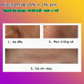 Niacinamide 10% ZinC 1% ngừa mụn trắng da LOOK ME. 