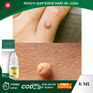 Obat Kutil Papiloma Obat Perontok Kutil Papiloma Obat Penghilang Kutil Obat Penghancur Kutil Obat Penghilang Skin Tag Obat Kutil Papiloma Di Leher Obat Penghilang Daging Tumbuh Obat Kutil di Wajah Obat Tetes Kutil Dengan Propolis SM
