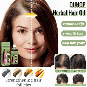 OUHOE Natural Herbal Hair Oil Prevents Hair Loss Growth Oil Nourishment Hair Essential Oil Smooth Hair Care Oil Help Hair Thicker 草本护发精油 生发油