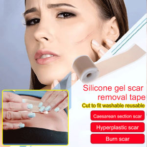 Lanrui Cesarean Section Scar Gel Patch: A Comprehensive Guide