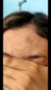 SBC GLOWING SUPER KEMASAN BARU SERUM DNA SALMON ORIGINAL 100%