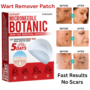 Salicylic Acid Wart Remover Patch Skin Tag Corn Remover Plaster Antibacterial Foot Callus Treatment Fast Healing Painless Removal