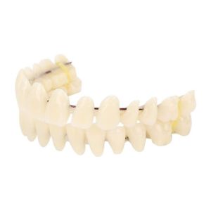 VCH 28 cái Răng giả bằng nhựa Tự làm Chắc chắn Mô hình đào tạo nha khoa Giá cả phải chăng Dễ sử dụng Mô hình giảng dạy răng Bệnh nhân