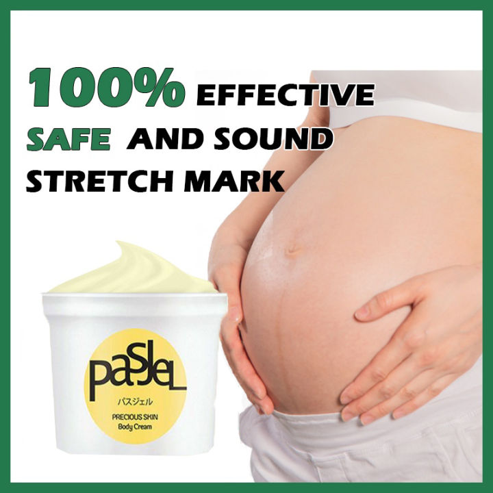 Stretch mark cream scar remover cream Stretch Marks Remover Skin Repair Cream 50g Special for Pregnancy Postpartum Care Remove pregnancy scars