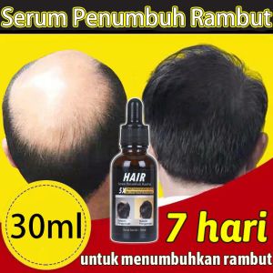 Pertumbuhan rambut penumbuh rambut cepat Ginger King Serum Anti Botak penumbuh rambut Penumbuh Rambut Secara Cepat Penyubur Rambut Rontok Pria