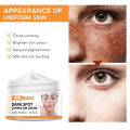Dark Spot Remover for Face Hyperpigmentation Treatment. Dark Spots Melasma Freckle Sun Spots Removal Dark Spot Corrector Cream. 