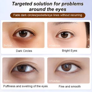 JC Anti Wrinkle Eye Serum Oil Hydrating Anti Aging Eye Treatment Reduces Fine Lines And Wrinkles Eye Care Skincare
