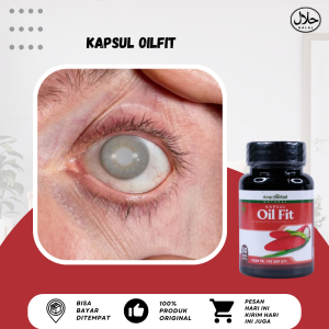 Obat Mata Katarak Obat Kornea Mata Obat Mata Putih Obat Mata Kornea Memutih Obat Penyakit Glaukoma Obat Hilangkan Bintik Putih Di Kornea Obat Mata Berselaput Putih Obat Katarak Senilis Obat Ulkus Kornea Ringan Kronis Dengan Oilfit