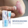 Psoriasis Antibacterial Ointment Topical Skin Ointment Inhibit Bacteria Relieve Itching Dermatitis Eczema Itchy Skin. 